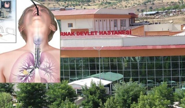 Şırnak’ta Bronskopi cihazı Bozok